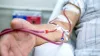 Kidney Specialist in Madurai - Nephrology Devadoss Hospital