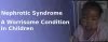 Nephrotic syndrome a worrisome condition in children