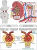 Nephrotic Syndrome Ayurvedic Treatment -Kidney and Ayurveda