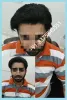 Hair Replacement in Gurgaon | Non Surgical Hair Replacement in Gurgoan