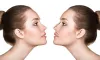 Rhinoplasty In Dubai -Nose surgery Dubai- Best rhinoplasty Dubai