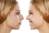 Why Rhinoplasty Is Best Nose Surgery to Straighten the Nose -