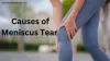 Causes of Meniscus Tear - Know the Signs | drramakantのブログ