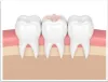 Is The Orthodontic Treatment Permanent in Nature?