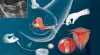 IUI – Know Its Procedures, Benefits, and Cost