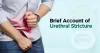 Urethral Stricture - Treatment & Management