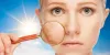 How To Get Rid Of Open Pores