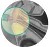 O Shot in San Diego | Allurant Medical Spa