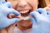 Orthodontic treatment