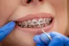 an orthodontist in Calgary