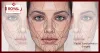 Correct your  functional & cosmetic  problem with orthognathic surgery  