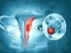 ovarian_surgery.jpg