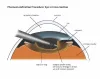 Cataract Surgery Pune, India | Cataract Treatment - Dada Laser Eye Institute