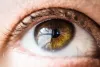 eye infection