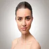 How Pigmentation Treatment Helps to Remove Spots from Face