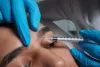 How long does a plasma eye lift take to work?