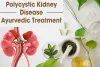 Is Polycystic kidney disease ayurvedic treatment reliable?