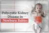 Can polycystic kidney disease in newborn babies naturally treated?