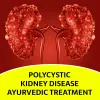 Polycystic kidney disease ayurvedic treatment