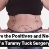 positive-and-negatives-of-a-tummy-tuck-surgery-96x96.jpeg