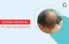 Lipoma surgery in Chennai