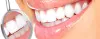 Preventive Dentistry Clinic in Coimbatore | Oral Hygiene Clinic 