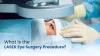 What Is the LASEK Eye Surgery Procedure | Dr. Jeevan Ladi
