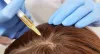 Hair Club Pakistan