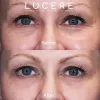 Best Skin Rejuvenation Clinic In Edmonton