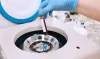 Best PRP Hair Treatment in Dubai - Amwaj Polyclinic
