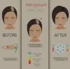 Cost of PRP Treatment for Hair Loss Delhi, PRP Face Treatment in Delhi