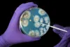 Pseudomonas Aeruginosa Infection, Symptoms and Treatment