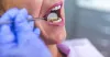 When to look for Emergency Dental Care?