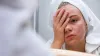 Why Do Some Teenagers Suffer More Acne Than Others?.