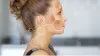 How to Remove Dark Spots Naturally?