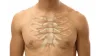 Minimally Invasive Aortic Valve Replacement – Micsheart