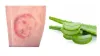 Red Dots On Skin: Causes &amp; Natural Remedies for Red Spots