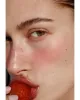 How Does InMode IPL Lumecca system Help To Reduce Redness And Rosacea? - Tight Clinic