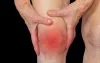 Dr. Srinivas Kasha - Best Computer Navigated Knee Replacement Surgeon 