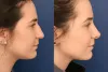 Dermatology in Dubai Myths Debunked: Separating Fact from Fiction