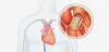 robotic mitral valve surgery
