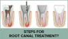 Root Canal Treatment in Dubai, Abu Dhabi &amp; Sharjah | Endodontic Crown Cost