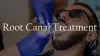 Root Canal Procedure &amp; Treatment Specialist | Root Canal Dentist