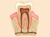 Have Questions About Root Canal Treatment? Get All Answers Here! - Blogs - WebDental, LLC