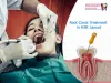  Precautions to Take When Going for a Root Canal Treatment         |          smiles-N-aesthetics 
