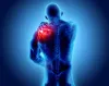 Rotator Cuff Injury - Symptoms, Causes and Treatment | ZENITH