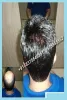 Hair Fixing cost in India | Permanent Hair Fixing | Good Hair Fixing in Delhi
