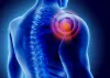 What can be the effective treatment to relieve shoulder pain?