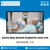 same day dental implants