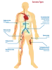 Types Of Cancer In Human